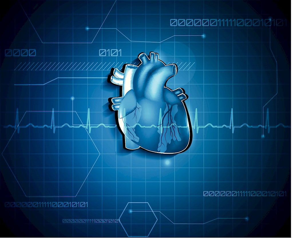 Sydäninfarktin hoitotulokset parantuneet Hyksissä