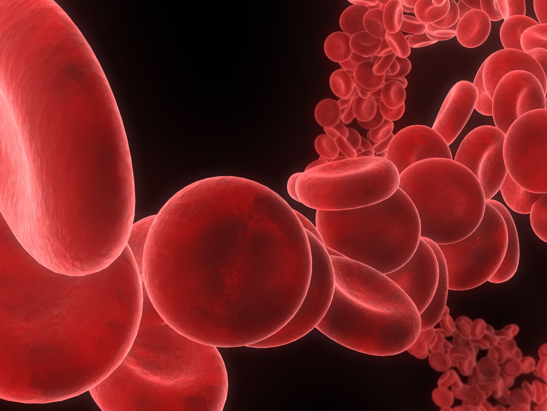 Korkea hemoglobiini leukemia