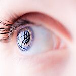 Endometrioosipotilaalla on usein siniset silmät