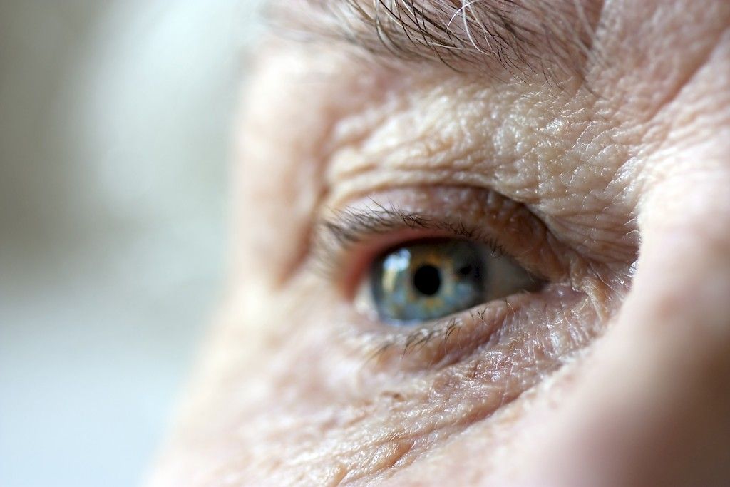 Suositus: Bevasitsumabi järkevä silmänpohjan ikärappeuman hoidossa