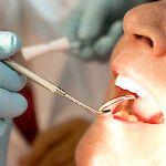 Hampaiden kiinnityskudosten tulehdus altistaa sydänkohtauksille