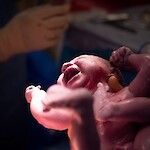 Synnyttäminen on turvallista Suomessa