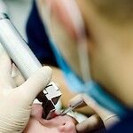 Huonot hampaat riski anestesiassa