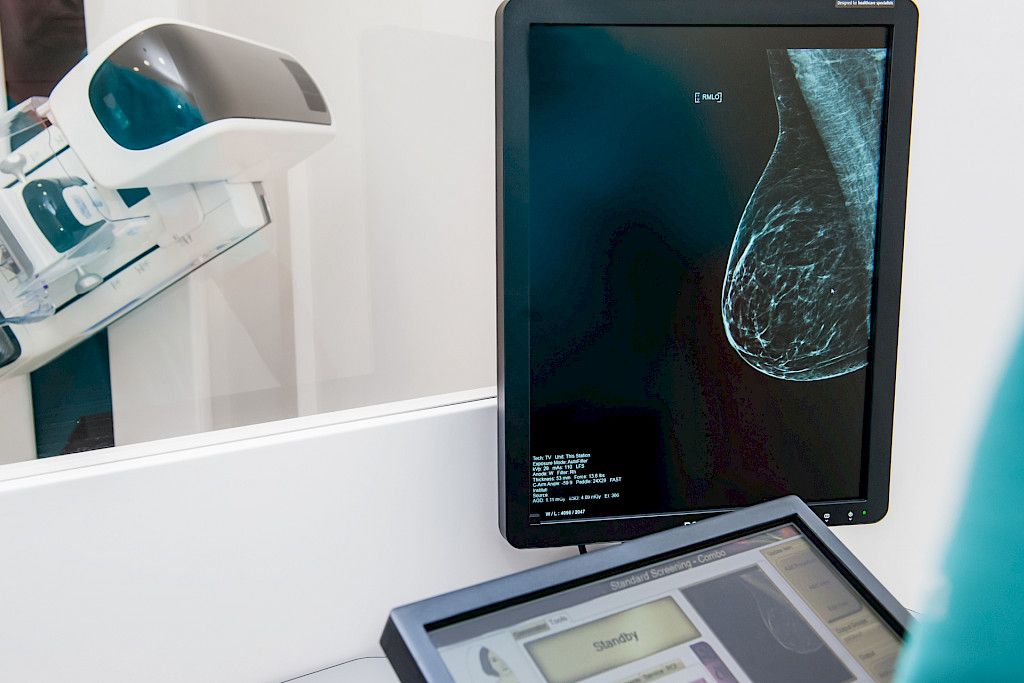 Tekoäly seuloi rintasyövän radiologia paremmin