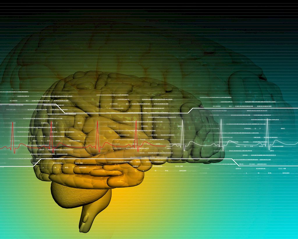 Aivojen tulehdusmuutokset yhteydessä Alzheimerin taudin varhaisiin amyloidikertymiin