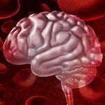 Aivoverenvuodosta selvinneen kannattaa parantaa elintapojaan