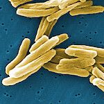 Keuhkojen ulkopuolisen tuberkuloosin osuus kasvaa