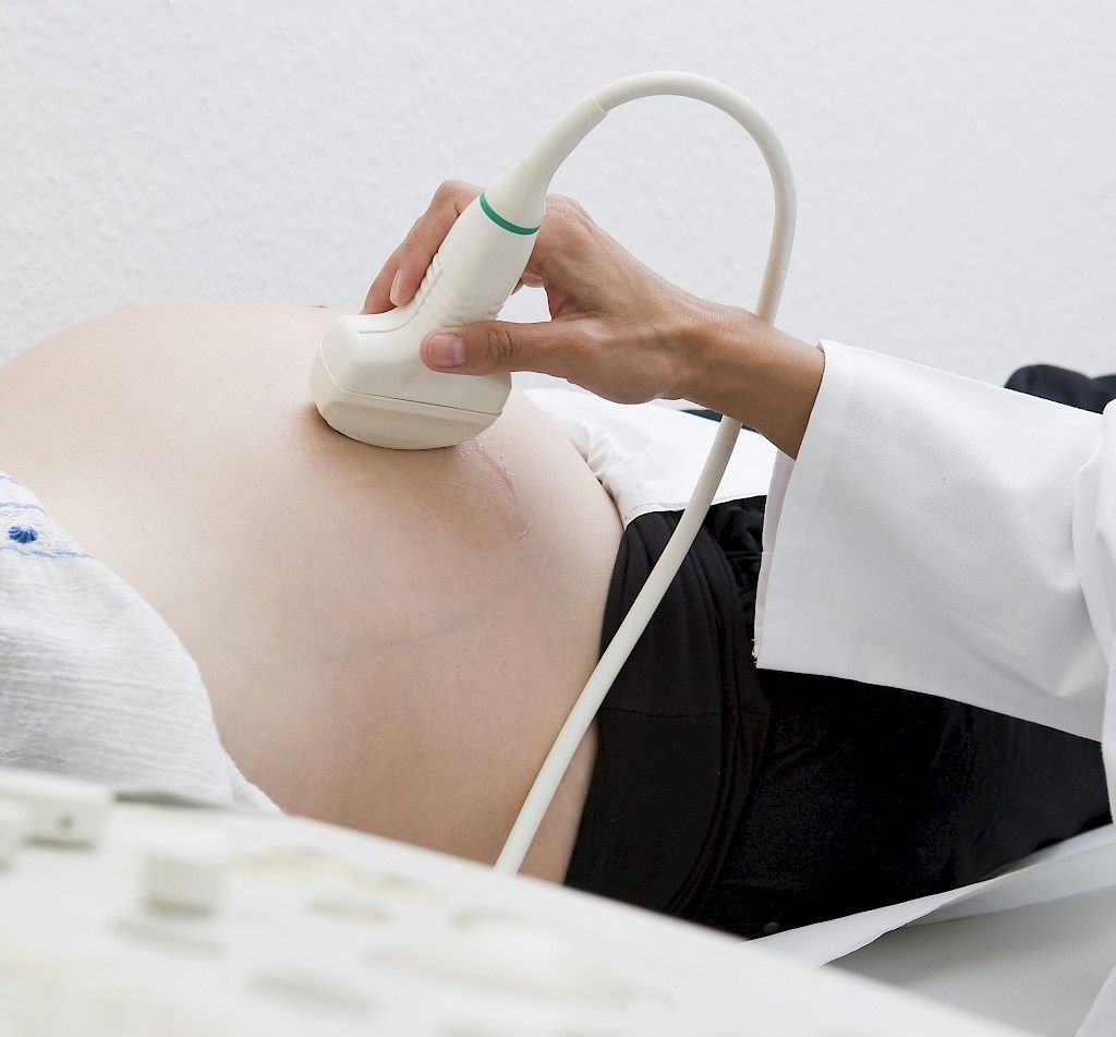Äidin ylipaino lisää ennenaikaisen synnytyksen riskiä