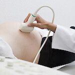 Äidin ylipaino lisää ennenaikaisen synnytyksen riskiä