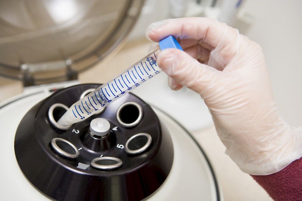 DNA-testi ja ulosteen veritesti eivät sovellu suolistosyöpien seulontaan
