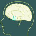 Aivolisäkekasvaimet vaikuttavat monen elimen toimintaan