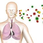 Vakava kotisyntyinen keuhkokuume