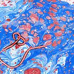 Espanjan Ebola-tartunta muistuttaa varautumisen tarpeesta
