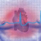 Sydämentahdistin ei estä magneettikuvausta