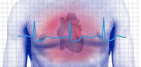 Sydämentahdistin ei estä magneettikuvausta