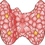 Kilpirauhaskohu näkyy endokrinologien vastaanotoilla