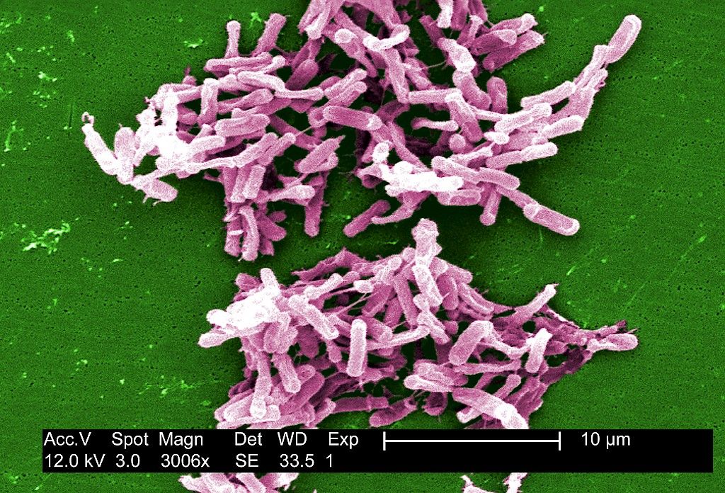 Ulostebakteereita sisältävät kapselit tehosivat Clostridium difficile -infektioon