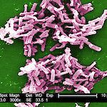 Ulostebakteereita sisältävät kapselit tehosivat Clostridium difficile -infektioon