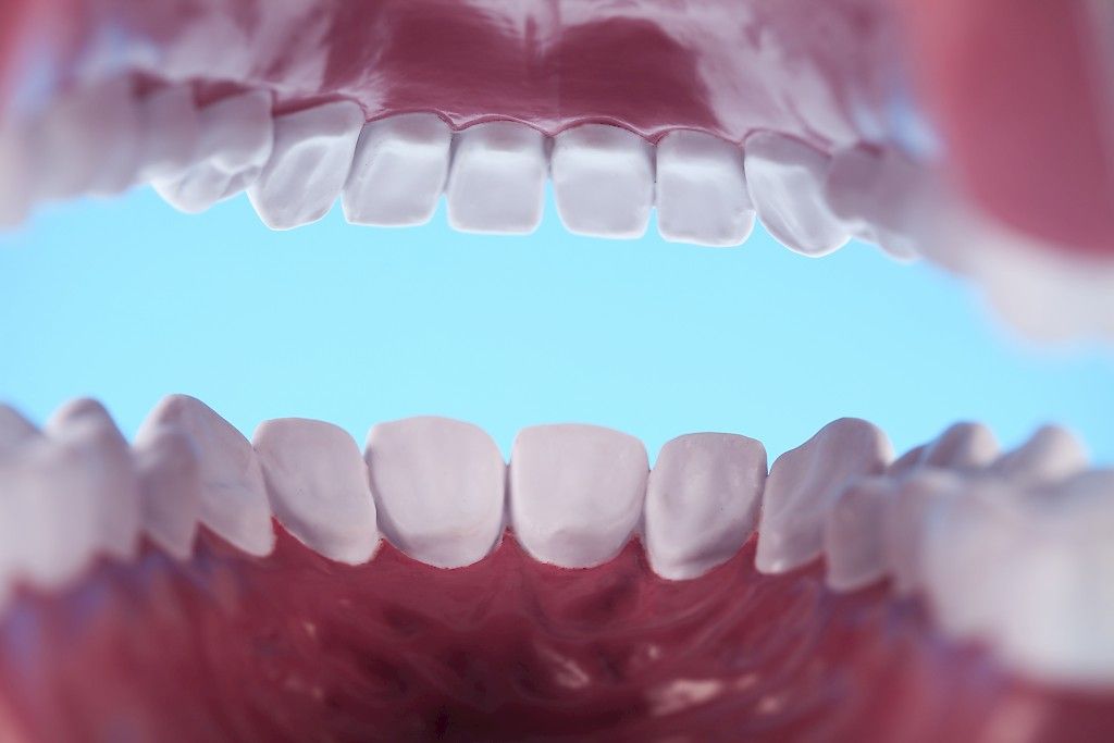 Parodontiitti: Salakavala hammasinfektio