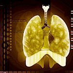 Keuhkosyöpä on maailman yleisin syöpä