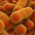 MDR-tuberkuloosi on lisääntynyt Suomessa
