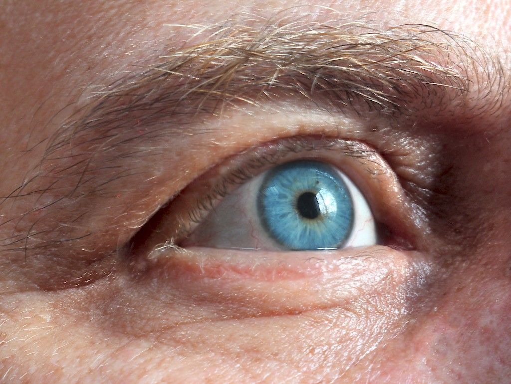 Tyypin 1 diabetekseen liittyviä silmäkomplikaatioita voi vähentää
