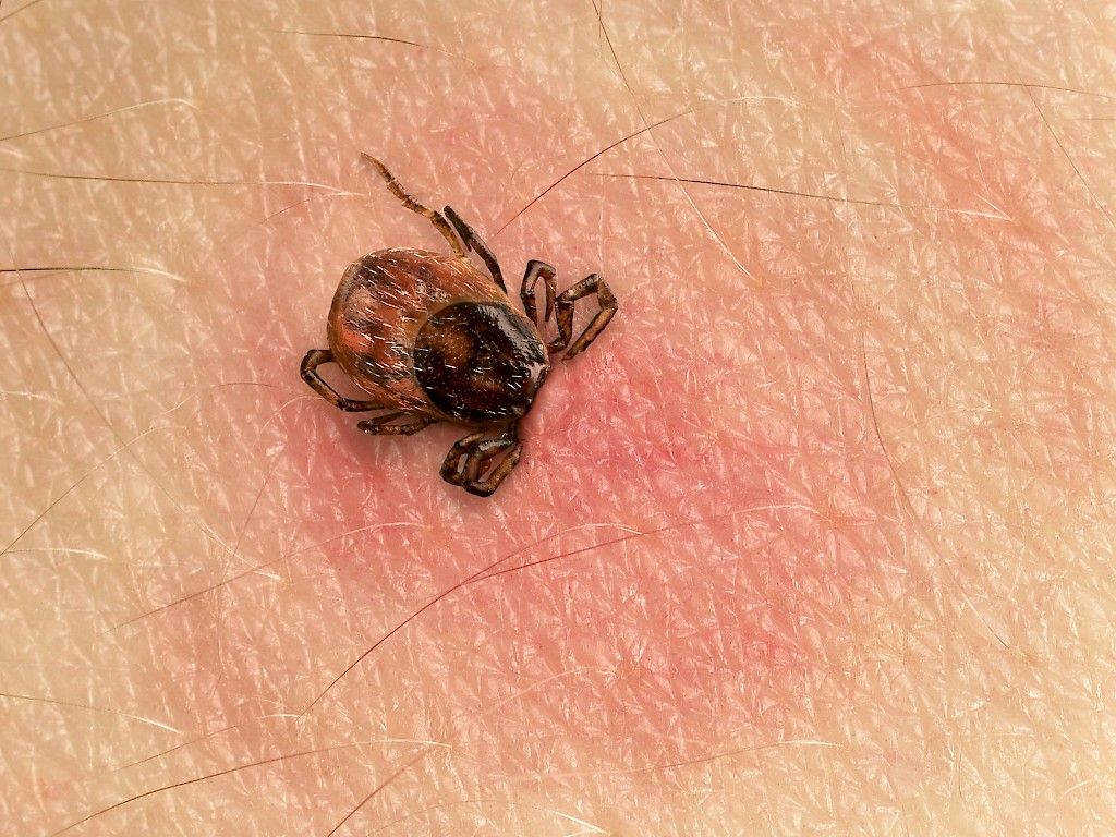 Miten borrelioosia hoidetaan Suomessa?