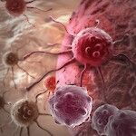 Suolistosyövän seulonnan vaikuttavuudesta ei vielä varmuutta