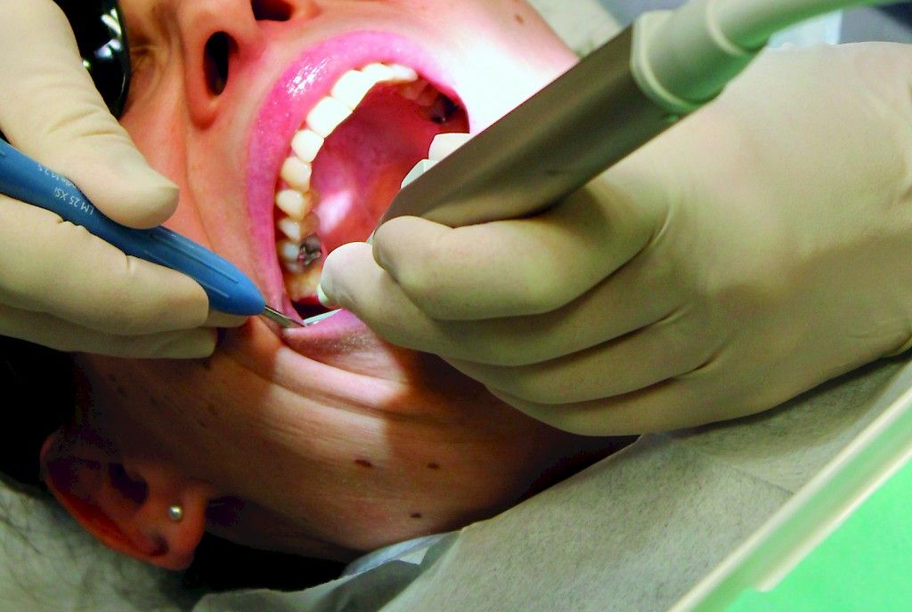 Valvira keskeytti hammasklinikan toiminnan