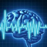 Kouristuspotilaiden oikea päivystyshoito varmistetaan pika-EEG:lla