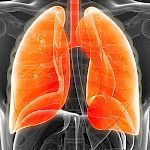 Tutkimus: 5 prosenttia kotona hoidetuista keuhkokuumepotilaista kuolemanvaarassa