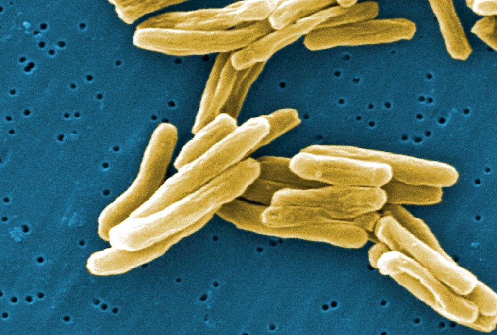 Tuberkuloosi tarttuu huonosti