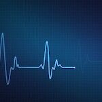 EKG kertoo sydämesi rytmin