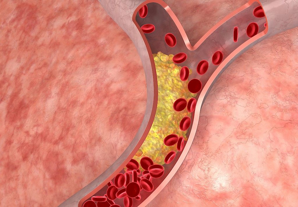 Kolesteroliarvo kertoo elintavoistasi