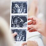 Ensimmäinen raskaus pakastetulla munasarjakudoksella Suomessa