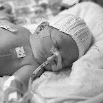 Anestesia vauvaiässä ei haittaa kehitystä