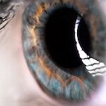 Mikä on ongelmana optikoiden silmänpohjakuvauksissa?