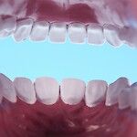 Voiko hampaiden narskuttelusta olla jotain hyötyä?