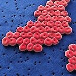 WHO kutsuu tutkijoita apuun superbakteerien nujertamiseksi