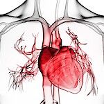 Hypotyreoosi lisää  hieman sydänsairausriskiä