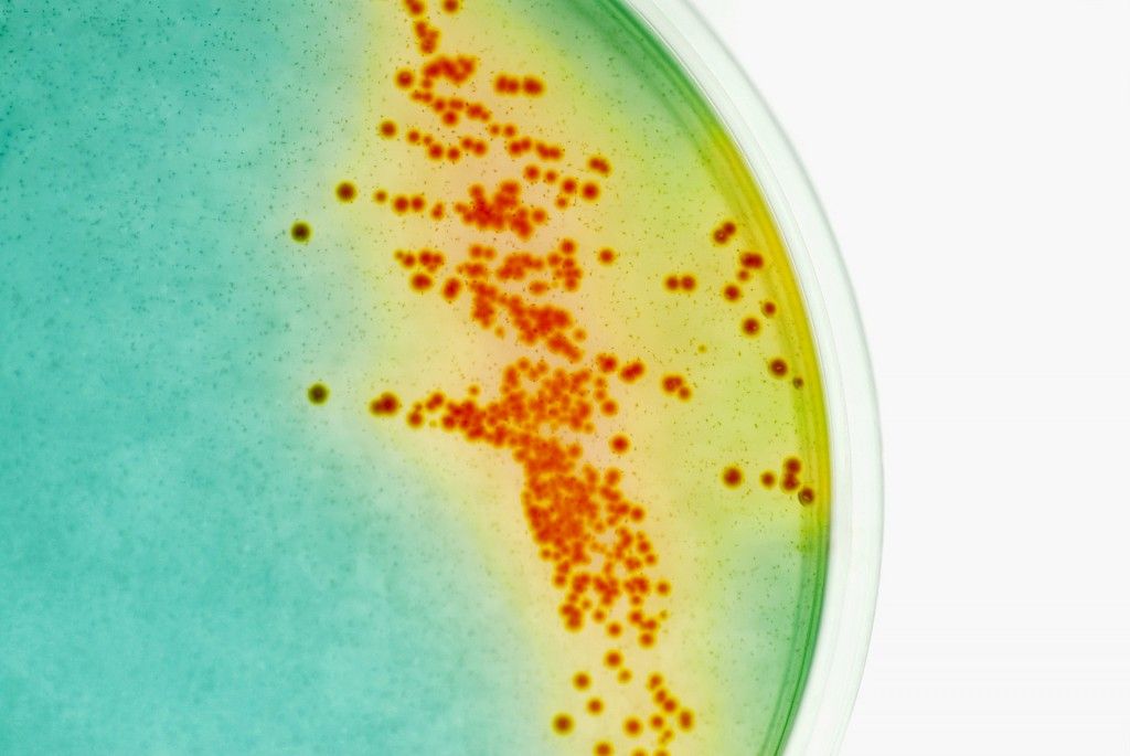 WHO: mikrobilääkeresistenssi vakava ongelma maailmanlaajuisesti