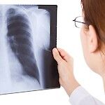 DNR-päätös on tärkeä osa keuhkoahtaumapotilaan hoitosuunnitelmaa