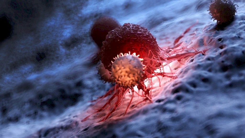 Ensimmäiset syöpäpotilaat hoidettu uudella immunologisella täsmähoidolla