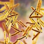 Viime vuonna tuberkuloosiin sairastui Suomessa 226 ihmistä