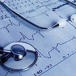 Terveyskeskusten EKG-tutkimusten määrässä suuret erot