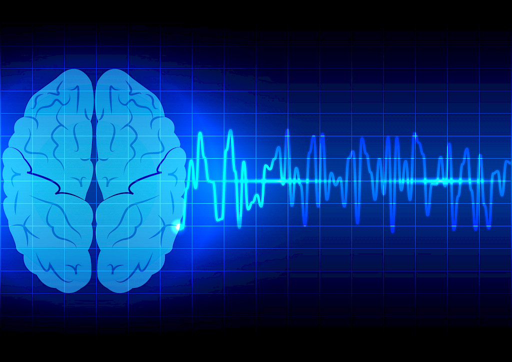 Voiko EEG löytää vakavia koronatapauksia?