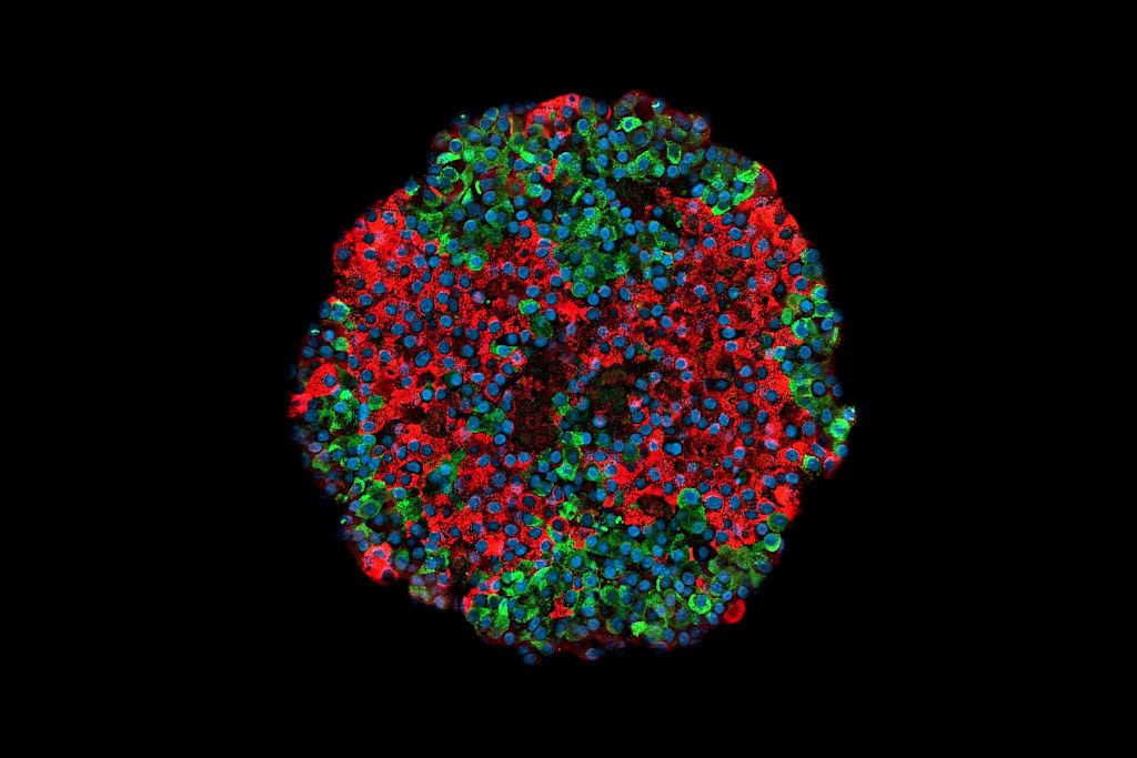 Kuvassa kantasoluista tuotettu haimasaareke. Insuliinia tuottavat solut näkyvät punaisena ja glukagonia tuottavat solut vihreinä. Kuva: Otonkoski Lab