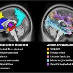 Masennuksesta toipuminen ja masennushoidot muokkaavat aivojen rakennetta