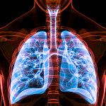 Jokainen astman pahenemisvaihe huonontaa keuhkojen toimintaa pysyvästi
