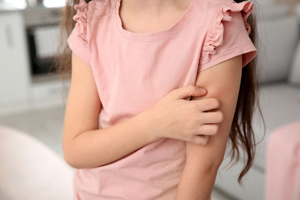 Lapsuudessa sairastetut tulehdussairaudet ovat usein yhteydessä myöhempiin allergioihin.
